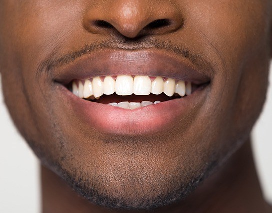 Smile with metal-free dental restoration