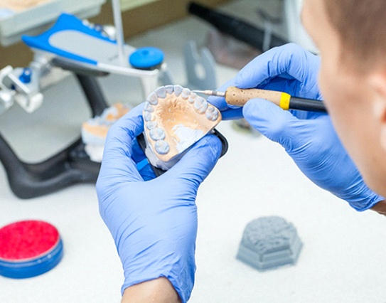 A dental lab technician creating a dental bridge based on the specifications provided by the dentist