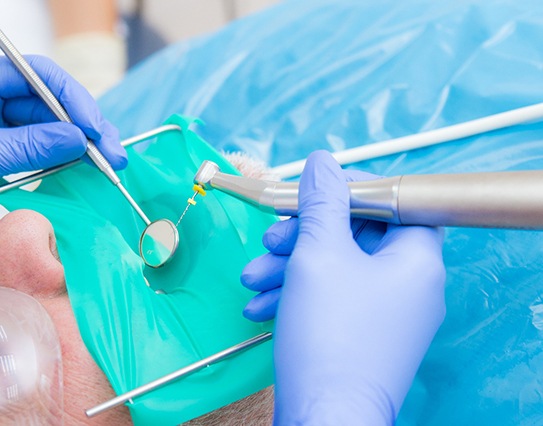 A dentist performing a root canal on a patient after placing the dental dam