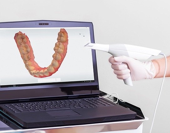 Digital impressions of teeth on chairside computer