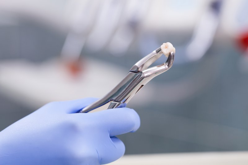 A dentist holding a tooth following a tooth extraction.