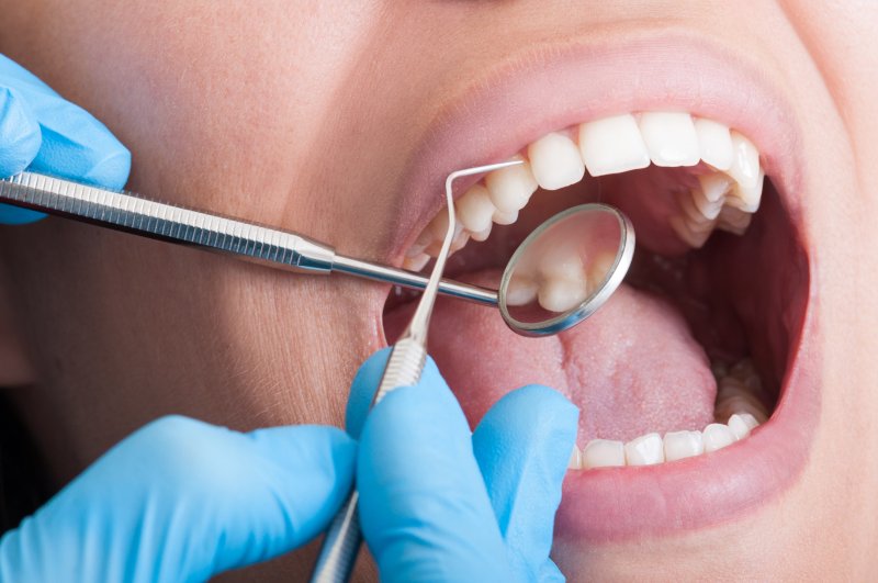 Dentist looking at the area between teeth